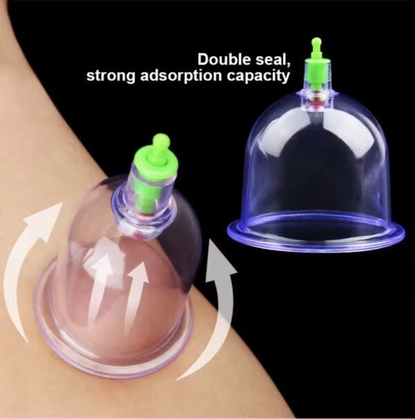 Vacuum Cupping Therapy Device – Safe, Adjustable, and Easy-to-Use - Image 2