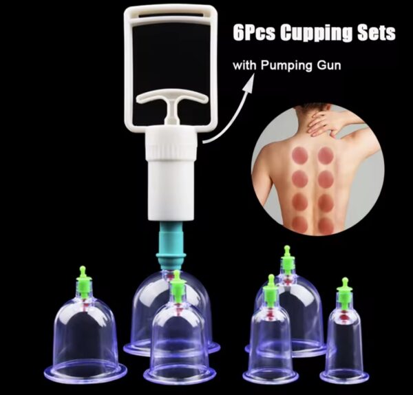 Vacuum Cupping Therapy Device – Safe, Adjustable, and Easy-to-Use - Image 6