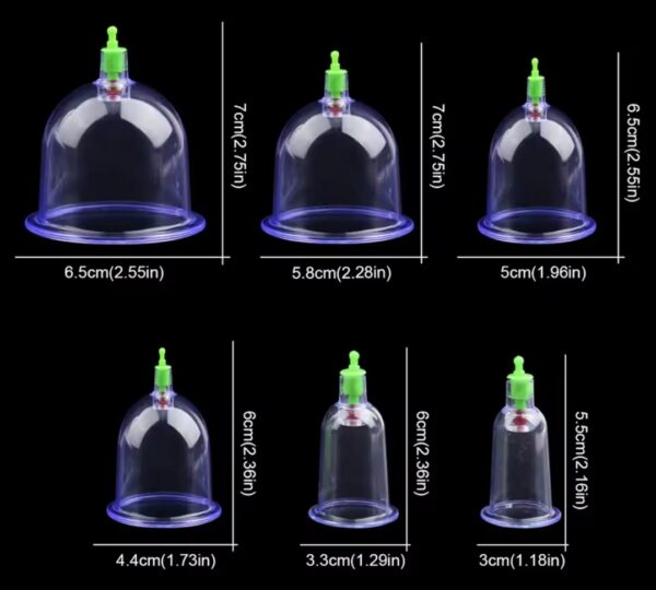 Vacuum Cupping Therapy Device – Safe, Adjustable, and Easy-to-Use - Image 5